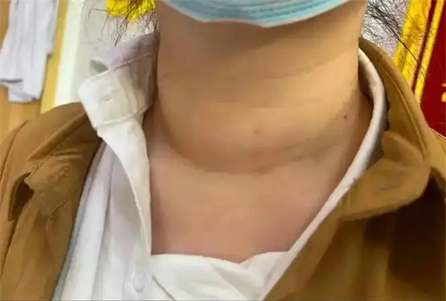 图片细节